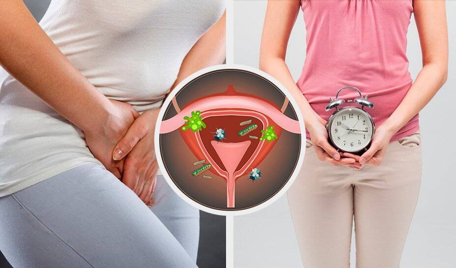 Выделения при месячных: норма, отклонения и причины их возникновения