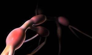 Воспаление мезентериальных лимфоузлов в брюшной полости у детей: причины лимфаденита