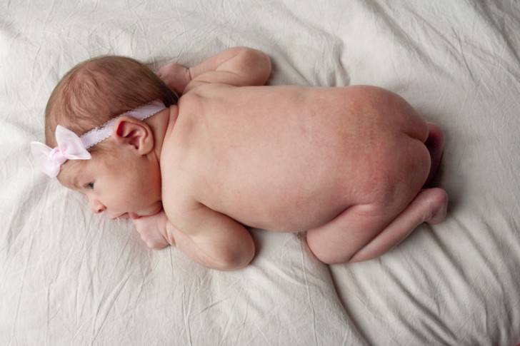 Сыпь в паху у ребенка - раздражение в интимной зоне, покраснение и зуд на половых органах