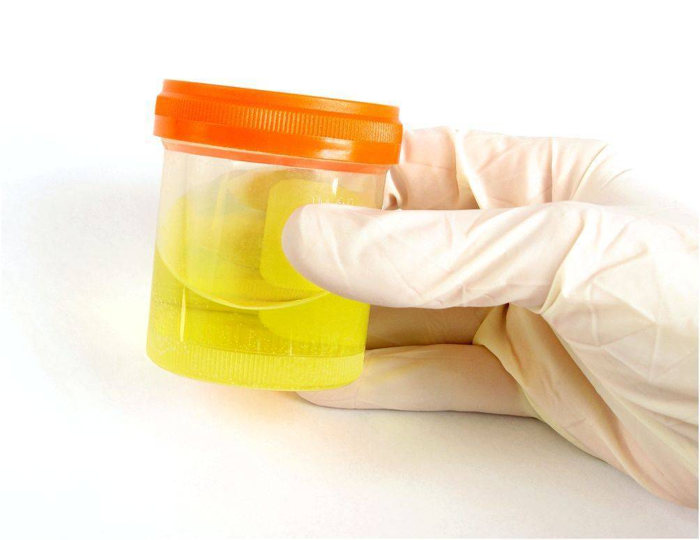 Сколько мочи надо для анализа ребенка-грудничка, какого объема будет достаточно?