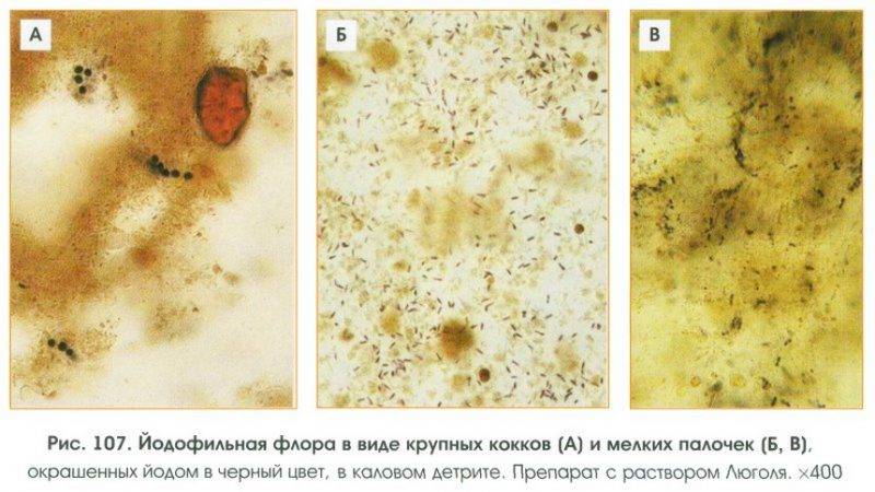 Что означает йодофильная патологическая флора в копрограмме у ребенка?