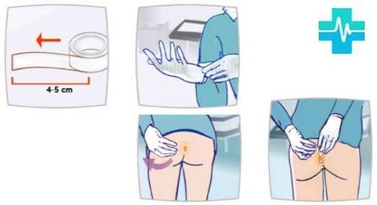 Обзор лекарств от остриц для детей и взрослых: список эффективных таблеток и суспензий