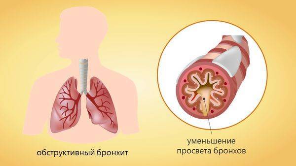 Мукалтин при грудном вскармливании (лактации): можно ли кормящей маме?