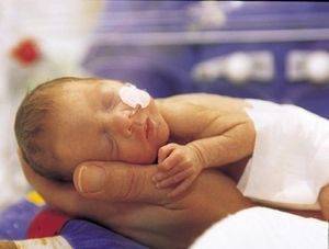 Гипотрофия у детей раннего возраста: 1, 2 и 3 степени (лечение, профилактика)