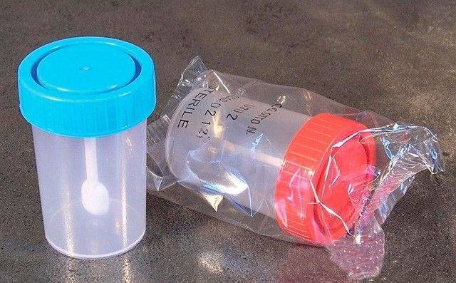 Как собрать кал на анализ у ребенка (грудничка и малыша старше года) и сколько его нужно?