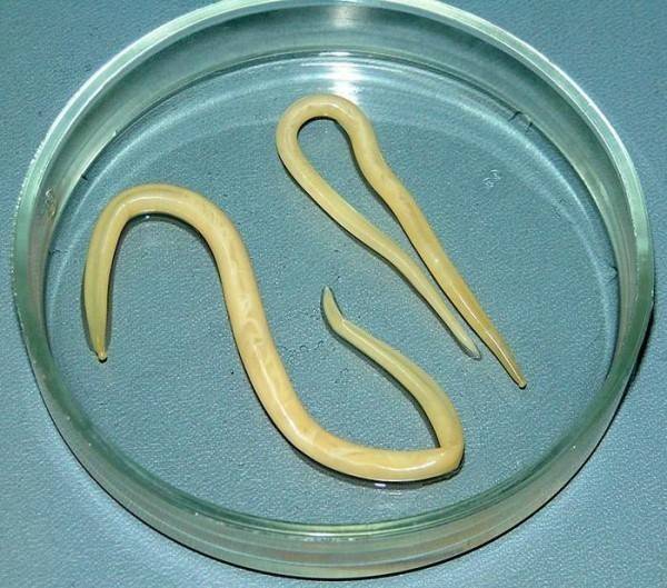 Глисты у детей: симптомы и лечение гельминтоза - как понять, есть ли паразиты в организме?