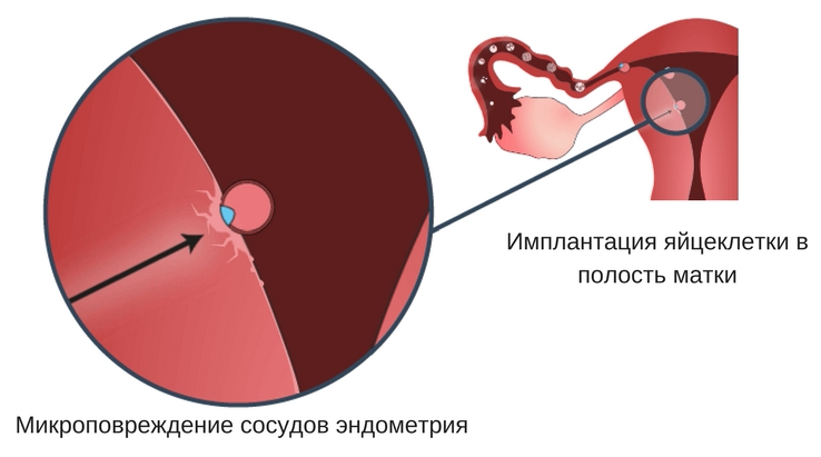 Месячные в середине цикла: причины кровянистых выделений на 12-17 день