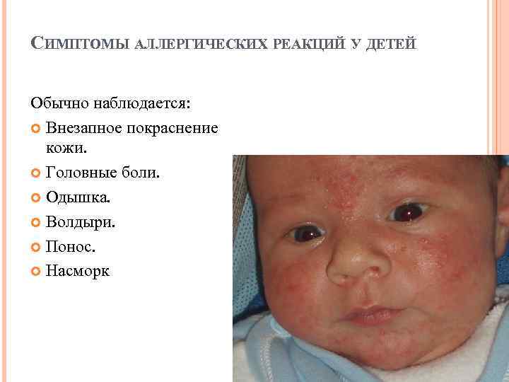 Как узнать на что аллергия у ребенка: способы определения потенциального аллергена