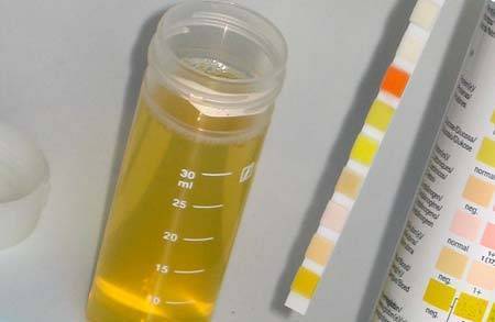 Как правильно сдавать анализ мочи при беременности с ватным тампоном?