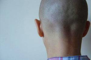 Ребенок ударился головой: на что обратить внимание, что делать, последствия ушиба затылком