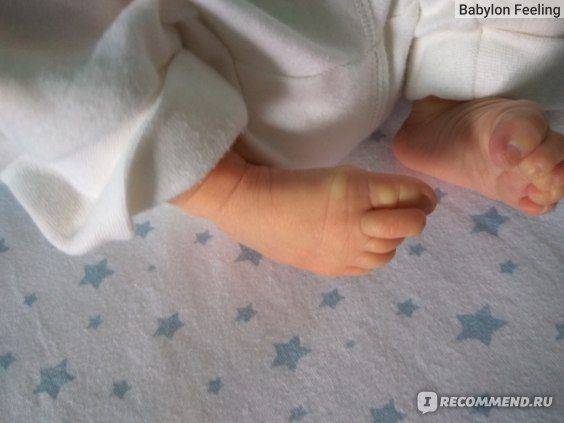 Неинвазивный тест Пренетикс: что можно кушать перед исследованием