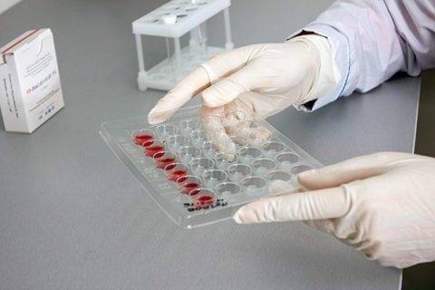 Цветовой показатель крови понижен у ребенка: причины, норма, лечение