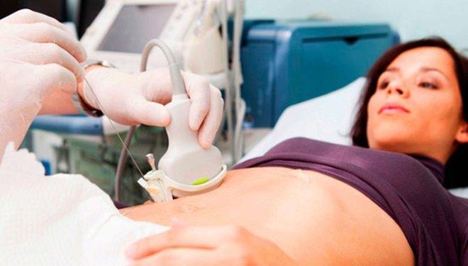 Бежевые выделения при беременности на ранних сроках светлого, желтого или коричневого оттенка