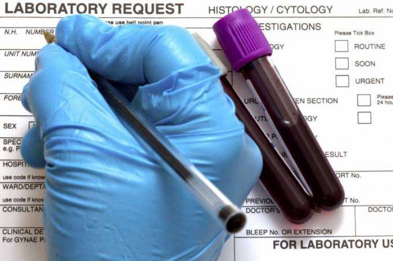 HLA-типирование супругов: что это такое, как происходит расшифровка результатов?