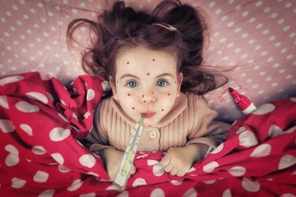 Ацикловир детям: инструкция по применению таблеток и мази при герпесе, ветрянке, ОРВИ