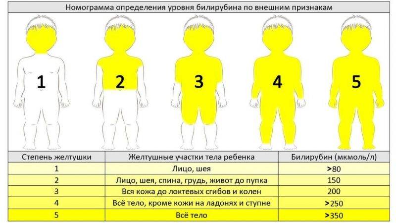 Фототерапия при желтухе у новорожденных: лечение в домашних условиях с помощью лампы