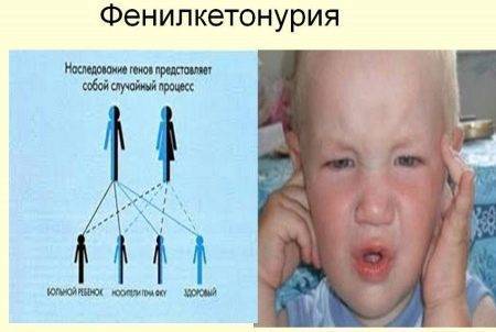 Неонатальный скрининг новорожденных в роддоме на наследственные заболевания (анализ крови из пятки)