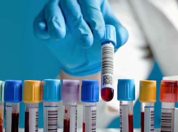 Эозинофилы у ребенка повышены или понижены: нормы крови, причины отклонений