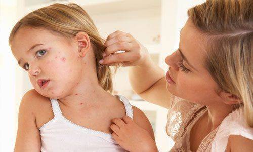 Красные точки во рту у ребенка - сыпь на слизистой неба и горла: фото с пояснениями