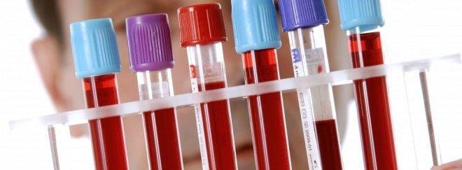 Анализ на мононуклеоз у детей - расшифровка показателей исследования крови