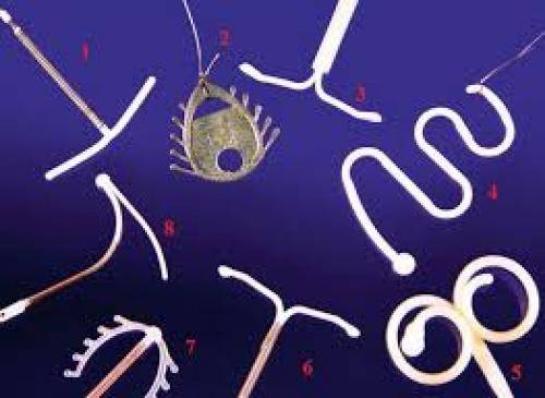 Удаление внутриматочной спирали: когда убирают ВМС, какие могут быть последствия?