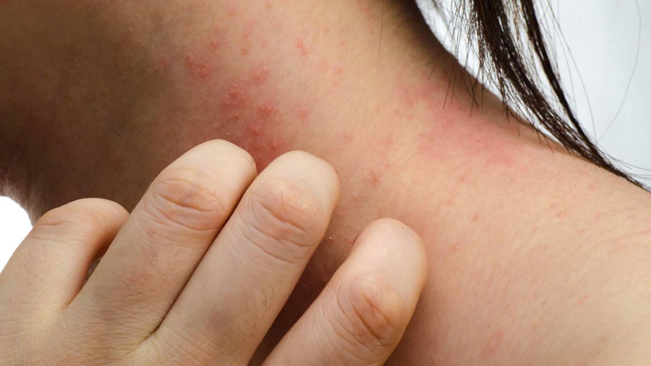 Шершавые пятна на теле у ребенка (на коже ног и рук, на спине и лице): фото