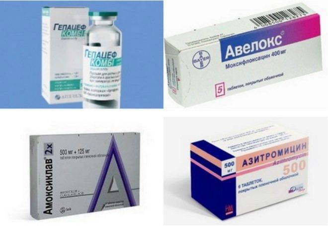 Лимфоузлы при ветрянке у детей: причины воспаления и появления шишек за ушами