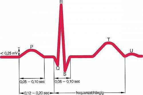 Расшифровка результатов ЭКГ у ребенка: нормы показателей и причины нарушений