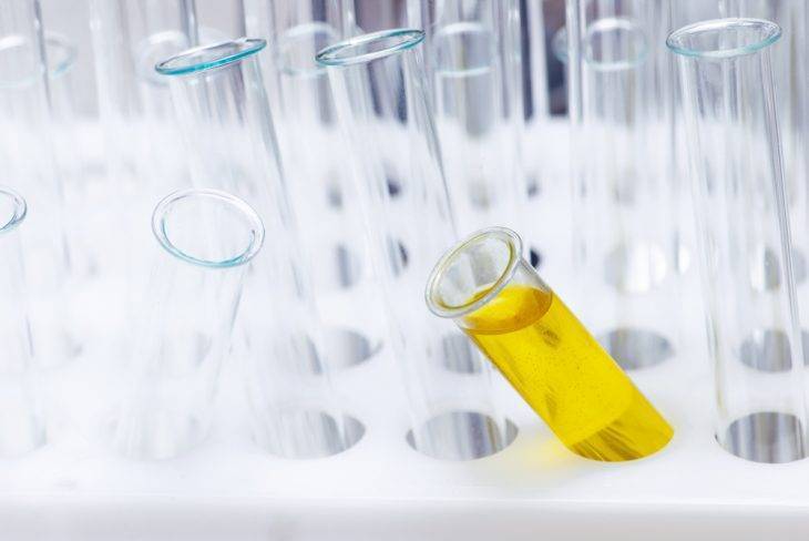 Анализ мочи по Зимницкому для детей: сбор материала, норма и расшифровка результатов