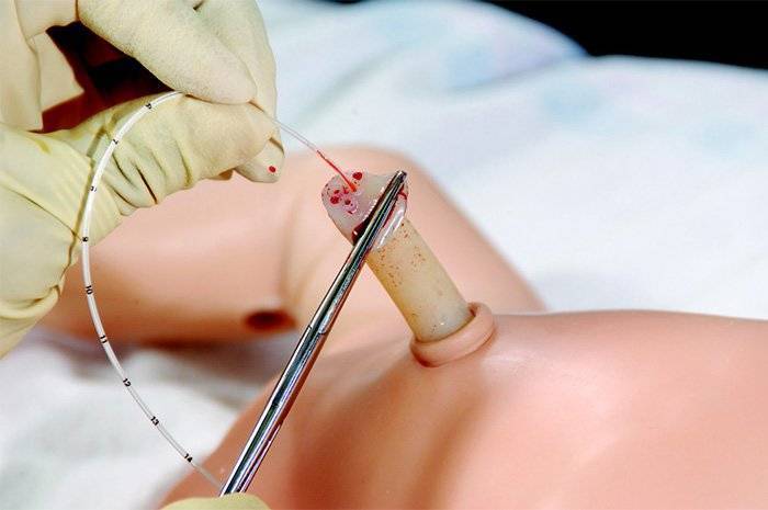 Повышенный билирубин у новорожденных: причины и последствия, норма показателя в анализе у детей