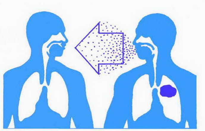 Инфекция "рука-нога-рот" у детей (энтеровирусный везикулярный стоматит): лечение вируса
