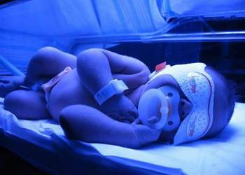 Желтуха у новорожденных: причины, последствия и лечение (физиологическая, неонатальная, ядерная)