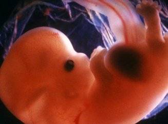 При каком ХГЧ слышно сердцебиение плода во время проведения УЗИ и видно эмбрион?