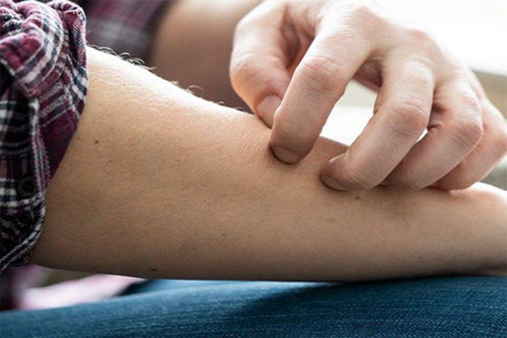 Ребенка укусил клещ: что делать, через какое время видны симптомы - фото и признаки укуса