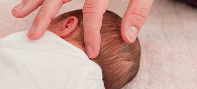 Родничок у новорожденных: когда зарастает темечко - нормы по месяцам