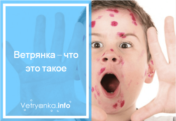 Лимфоузлы при ветрянке у детей: причины воспаления и появления шишек за ушами