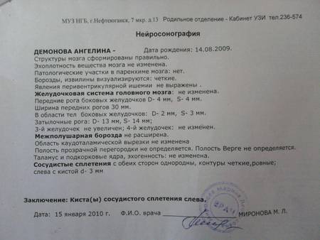 Нсг головного мозга новорожденных и детей до года: что показывает узи (нейросонография)? | диагностика | vpolozhenii.com