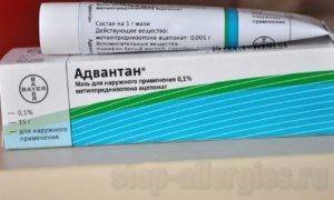 Аллергия у ребенка: фото, симптомы и лечение, профилактика кожных аллергических реакций