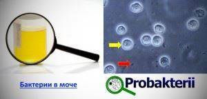 Кровь в моче у ребенка - что это значит и почему появляются ее следы и сгустки в урине?