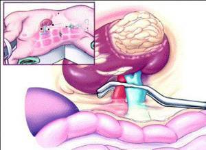 Гипоплазия почки у ребенка: причины, симптомы и лечение