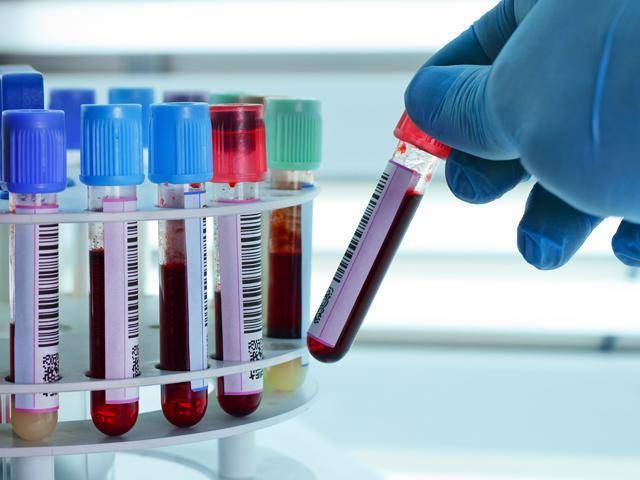 Пролактин и прогестерон: связь этих гормонов, причины их повышения и понижения