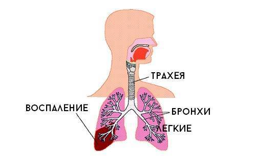 Ребенок кашляет после бега и другой физической нагрузки: причины и способы решить проблему