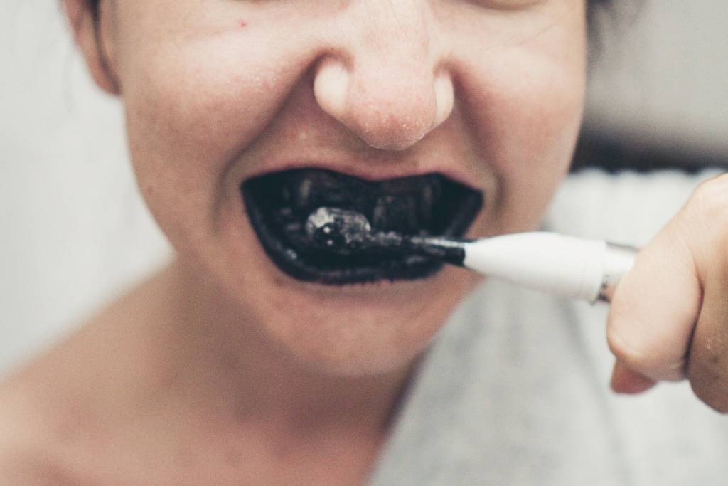Желтый налет на зубах у ребенка: почему появляются пятна и что делать?