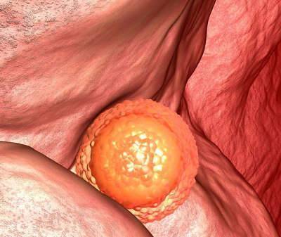 Качество эмбрионов для переноса: классификация и шансы на имплантацию