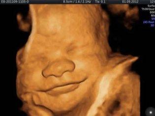 УЗИ на 34 неделе беременности: показатели нормы у плода и будущей матери