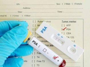 Как определить по моче беременность, покажет ли общий анализ ее наличие?