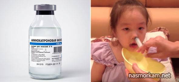 Аминокапроновая кислота в нос детям: инструкция по применению для ингаляций при насморке и дозировка