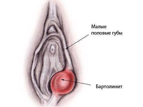Детская матка: можно ли забеременеть и родить женщине с такой патологией?