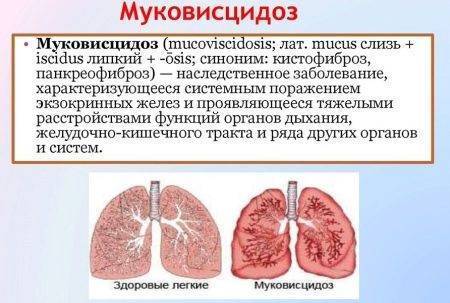Неонатальный скрининг новорожденных в роддоме на наследственные заболевания (анализ крови из пятки)