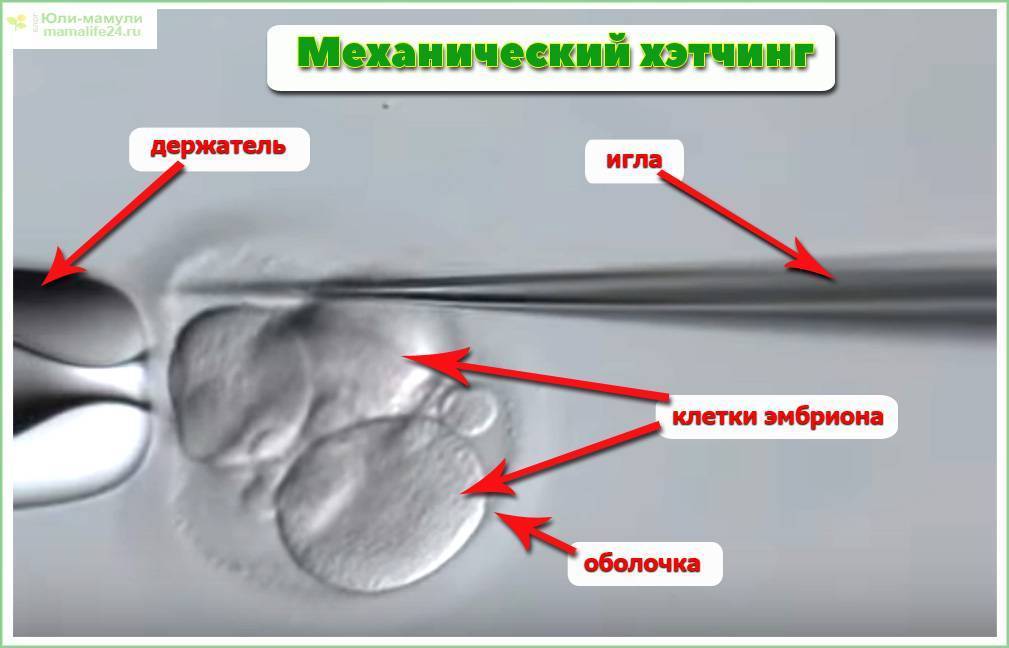 Хетчинг эмбрионов: что это такое, для чего проводится, возможны ли осложнения?